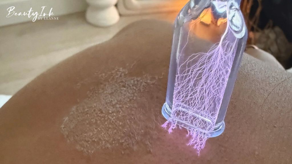 How Cold Plasma Treatment Works: The Science Behind Skin Healing and Regeneration